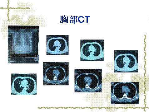 叼嘿视频在线观看