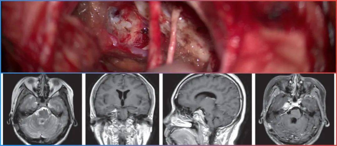 瑞邦小车 学习资源或产品分析