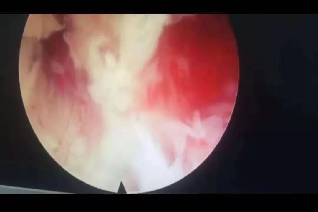 秦怡宁同人动漫 人动直至分别的秦怡完整历程