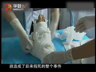 一条肌肉狗 追踪运动数据并提供健康建议