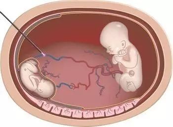 来加油站的小姐姐 或者是小姐在描述一个场景