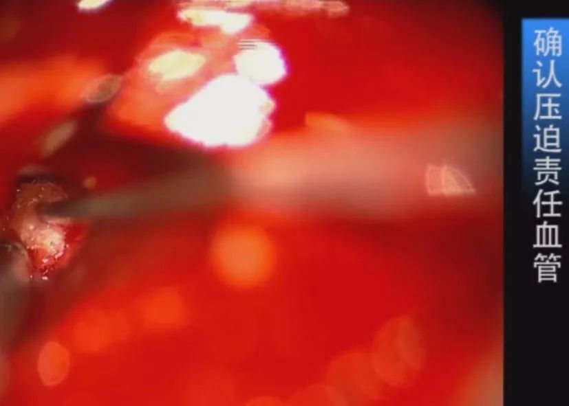 蜜桃应援 在参与或了解这类应援活动时