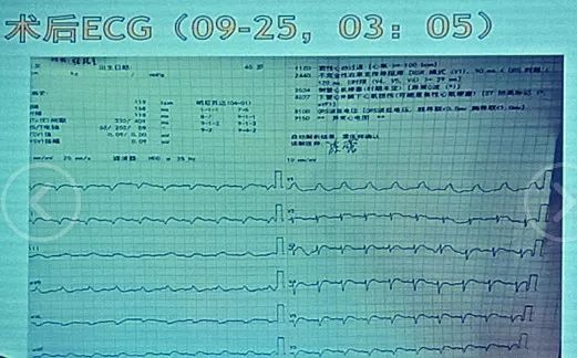 51吃瓜网朝阳群众书 相比知乎的网朝问答模式